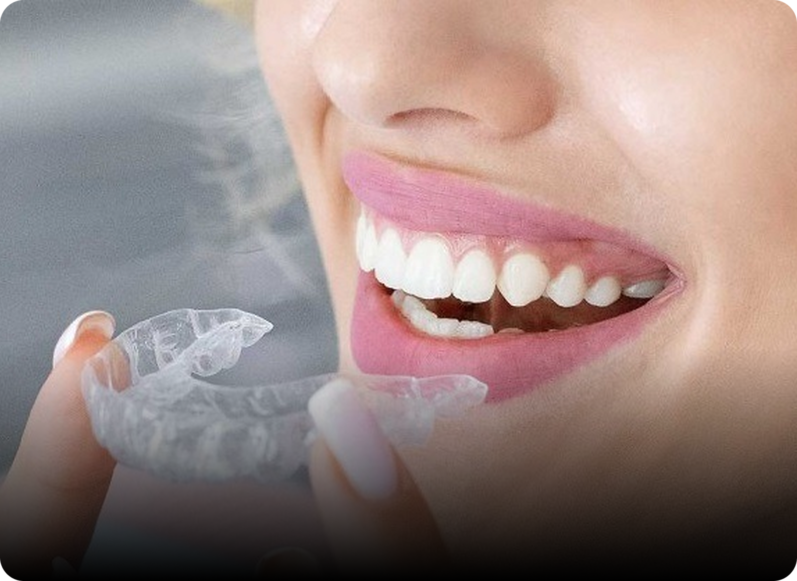 Orthodontics & Clear Aligners