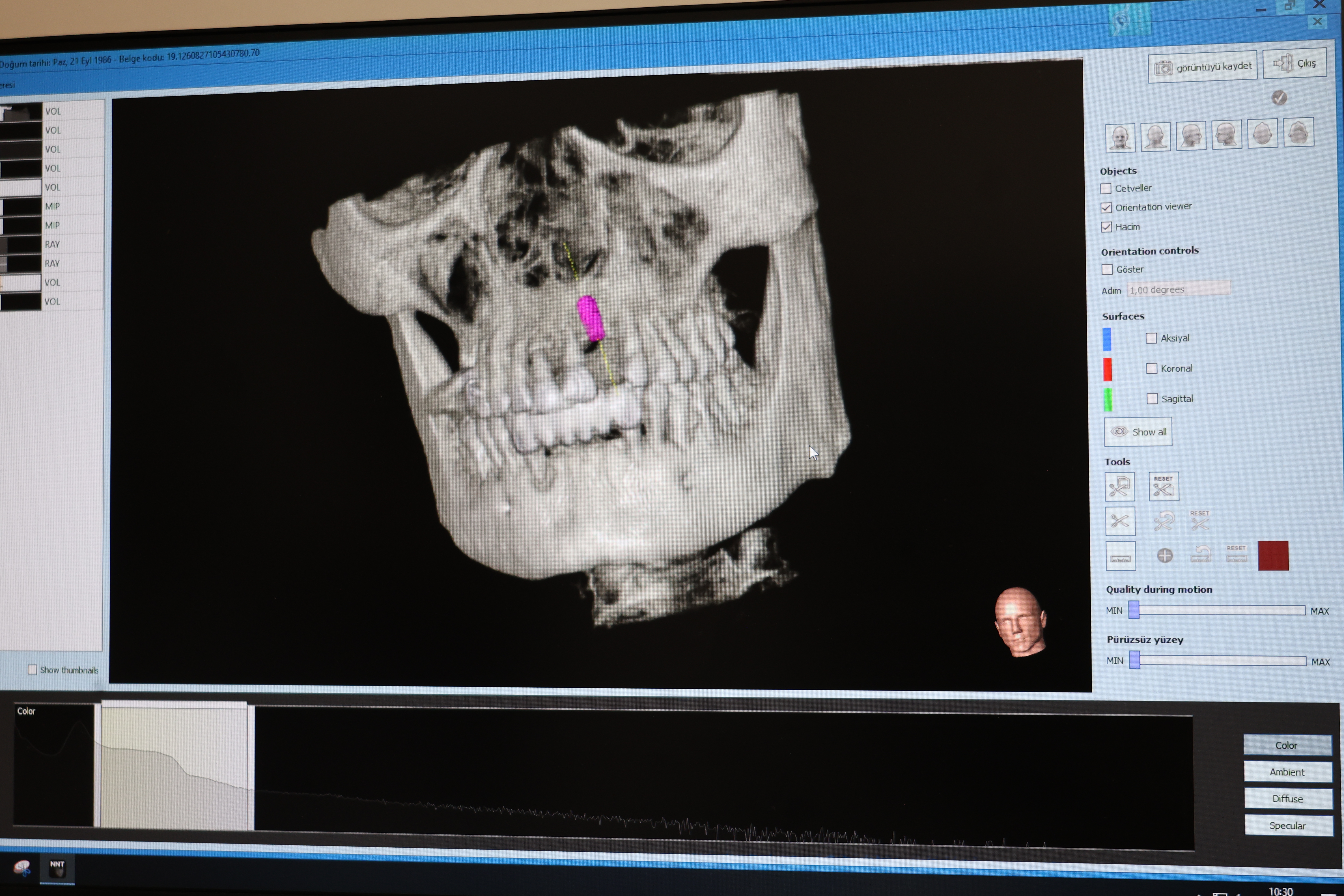 Digital Dentistry